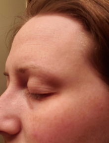 After - Cambio real en 3 meses